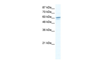ZNF232 Rabbit Polyclonal Antibody