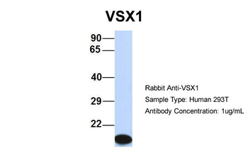 VSX1 Rabbit Polyclonal Antibody