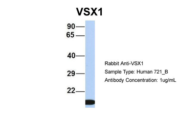 VSX1 Rabbit Polyclonal Antibody