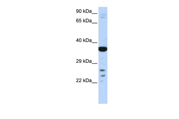 VSX1 Rabbit Polyclonal Antibody