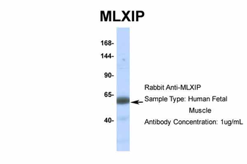 MLXIP Rabbit Polyclonal Antibody