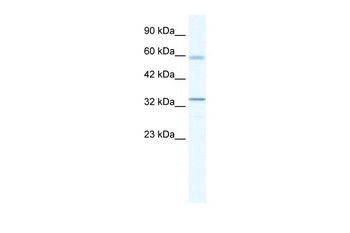ZBTB7A Rabbit Polyclonal Antibody