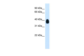 ETV7 Rabbit Polyclonal Antibody