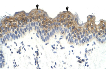 LW-1 Rabbit Polyclonal Antibody
