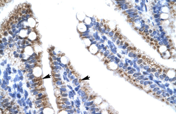 ZNF12 Rabbit Polyclonal Antibody