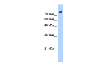 PHF20 Rabbit Polyclonal Antibody