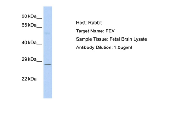 FEV Rabbit Polyclonal Antibody