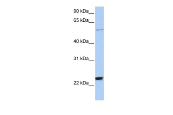 ZNF83 Rabbit Polyclonal Antibody