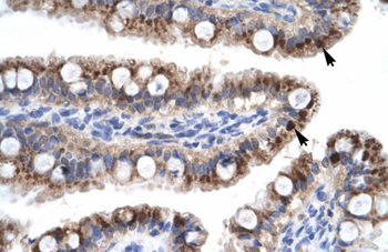 ZNF167 Rabbit Polyclonal Antibody