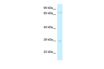 MESP1 Rabbit Polyclonal Antibody