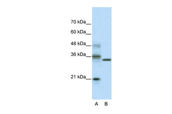 HES4 Rabbit Polyclonal Antibody