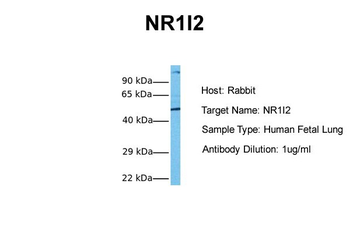 NR1I2 Rabbit Polyclonal Antibody