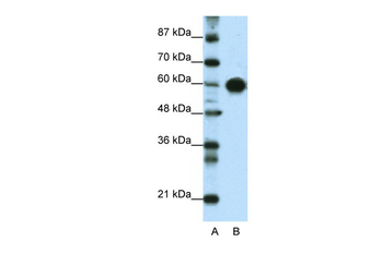 ZSCAN5 Rabbit Polyclonal Antibody