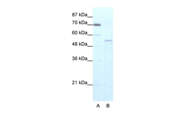 ZNF665 Rabbit Polyclonal Antibody