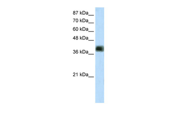 ZNF435 Rabbit Polyclonal Antibody