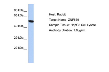 ZNF559 Rabbit Polyclonal Antibody
