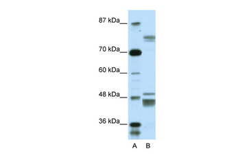 ZNF607 Rabbit Polyclonal Antibody