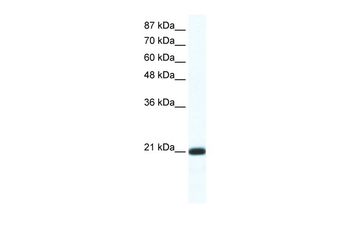 RAXL1 Rabbit Polyclonal Antibody