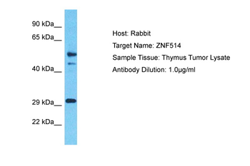 ZNF514 Rabbit Polyclonal Antibody