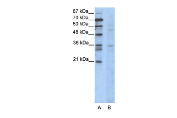 CCNB3 Rabbit Polyclonal Antibody