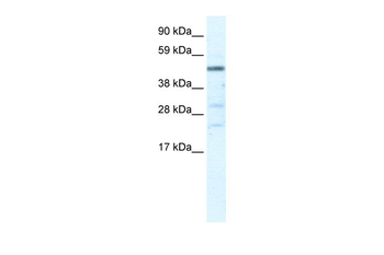 HSFY1 Rabbit Polyclonal Antibody