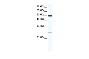 ZFP91 Rabbit Polyclonal Antibody