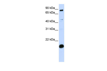 SP110 Rabbit Polyclonal Antibody