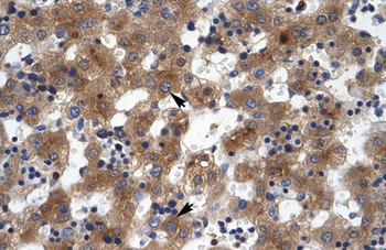 ZNF551 Rabbit Polyclonal Antibody