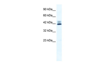 ZNF551 Rabbit Polyclonal Antibody