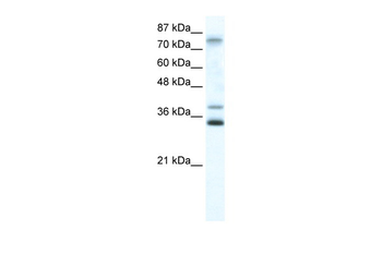 ZNF570 Rabbit Polyclonal Antibody