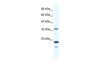 ZNF688 Rabbit Polyclonal Antibody