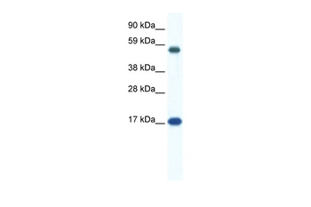 ZNF554 Rabbit Polyclonal Antibody