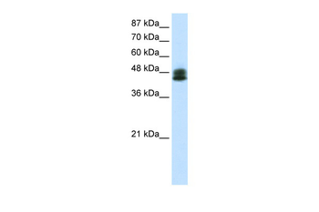 ZNF785 Rabbit Polyclonal Antibody