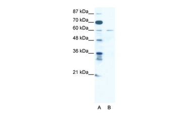 ZNF92 Rabbit Polyclonal Antibody