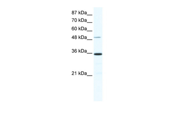 ZNF610 Rabbit Polyclonal Antibody