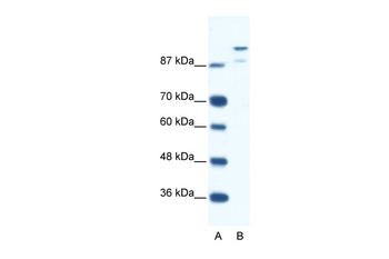 HKR1 Rabbit Polyclonal Antibody