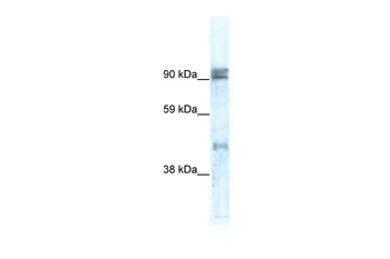 ZNF227 Rabbit Polyclonal Antibody