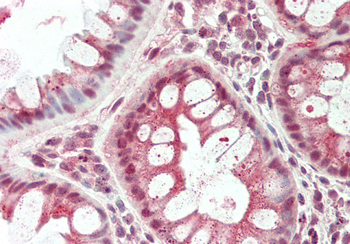 TSC22D1 Rabbit Polyclonal Antibody