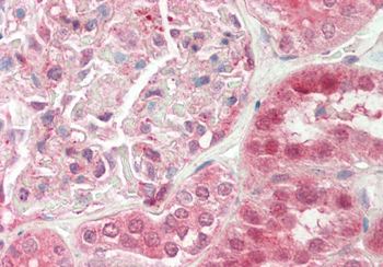 TSC22D1 Rabbit Polyclonal Antibody