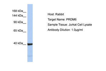 PRDM6 Rabbit Polyclonal Antibody