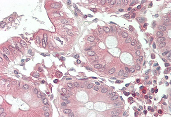 KIAA1618 Rabbit Polyclonal Antibody