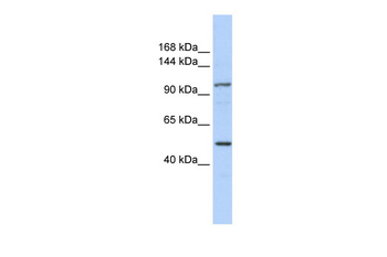 KIAA1618 Rabbit Polyclonal Antibody