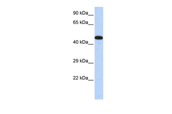 AKAP5 Rabbit Polyclonal Antibody
