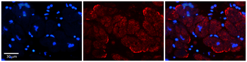 AKAP7 Rabbit Polyclonal Antibody