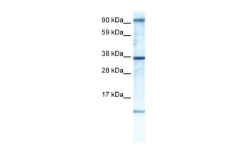 AKAP7 Rabbit Polyclonal Antibody