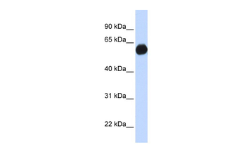 AKAP1 Rabbit Polyclonal Antibody