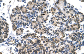 DHX9 Rabbit Polyclonal Antibody