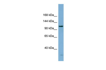 DHX15 Rabbit Polyclonal Antibody
