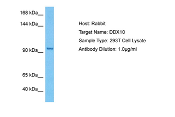 DDX10 Rabbit Polyclonal Antibody
