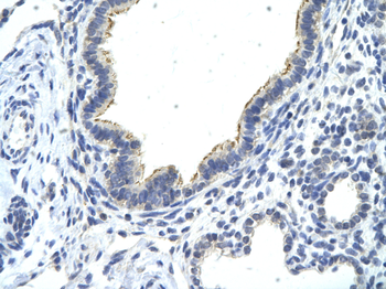 DDX21 Rabbit Polyclonal Antibody